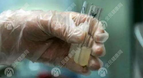 国产精子窝 在线视频,揭秘精子采集与储存的神秘世界